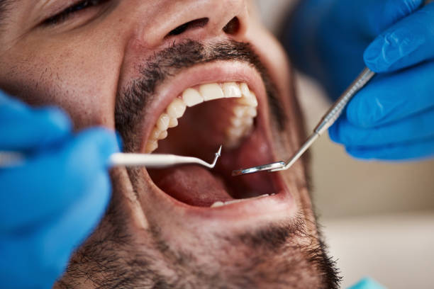 Best Urgent Tooth Repair  in Grand Terrace, CA